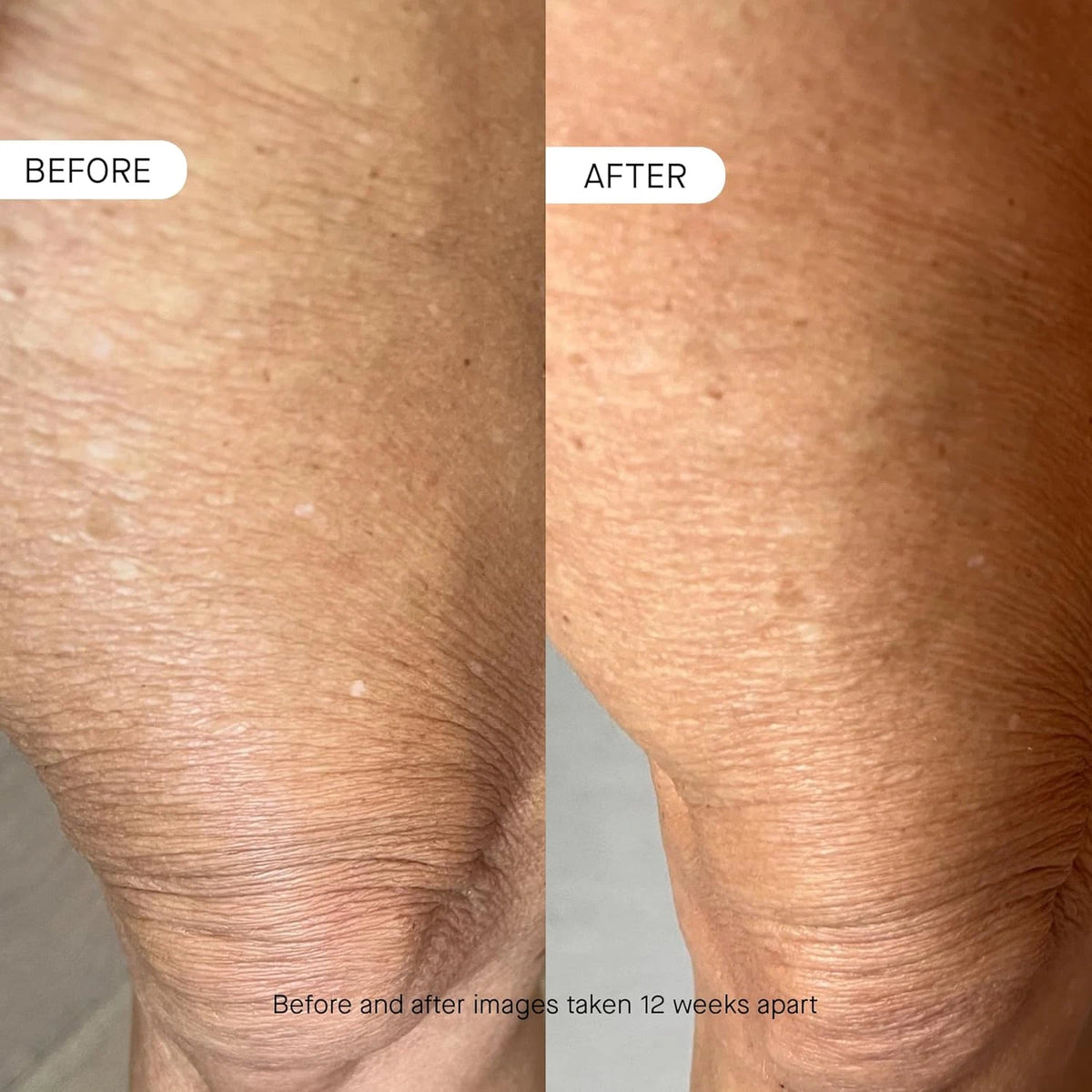 BODY OS-01 Peptide Skin Longevity Daily Moisturizer- Improves Skin Texture