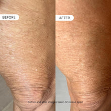 Load image into Gallery viewer, BODY OS-01 Peptide Skin Longevity Daily Moisturizer- Improves Skin Texture
